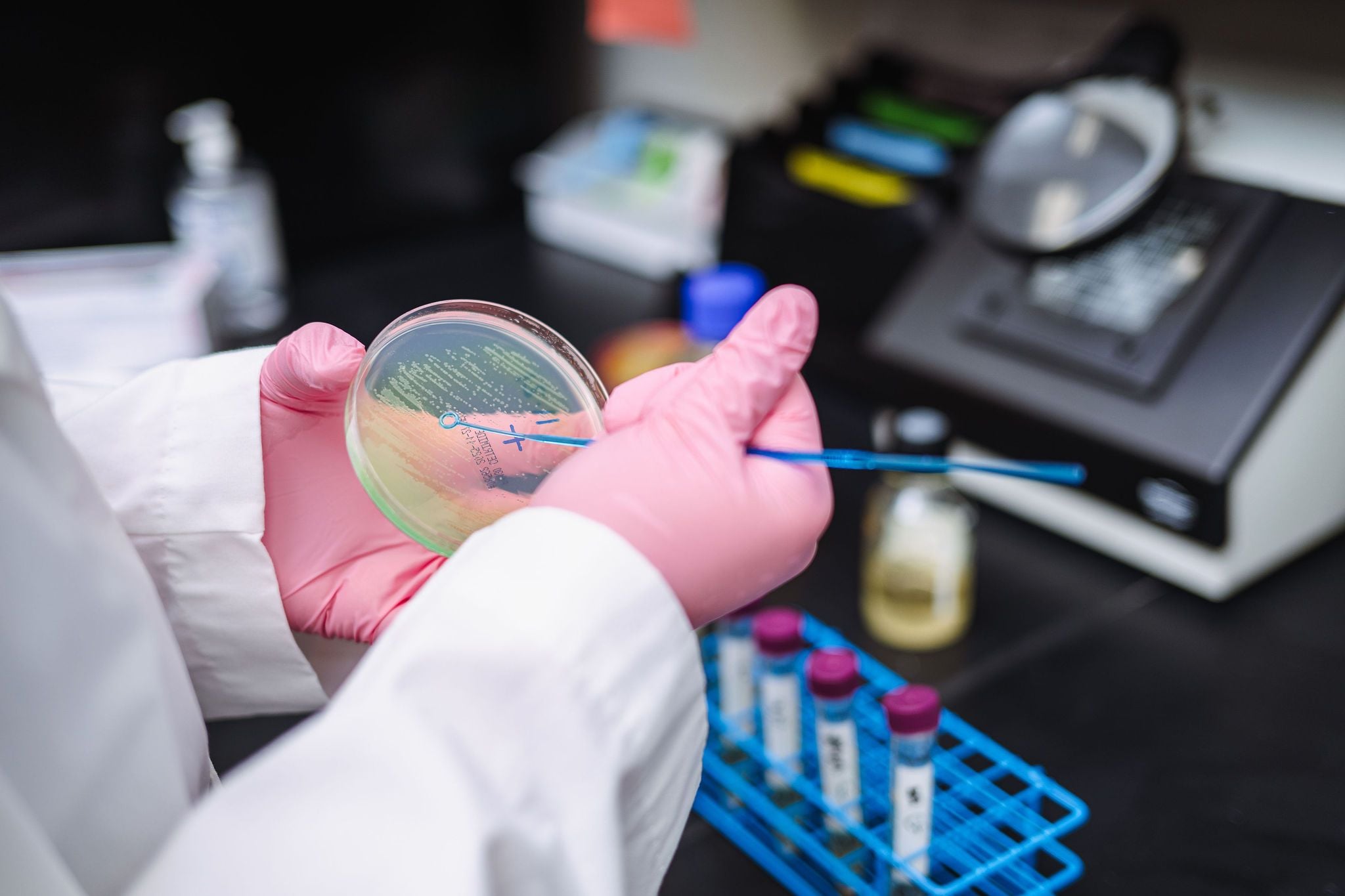 Petri dish culture analysis